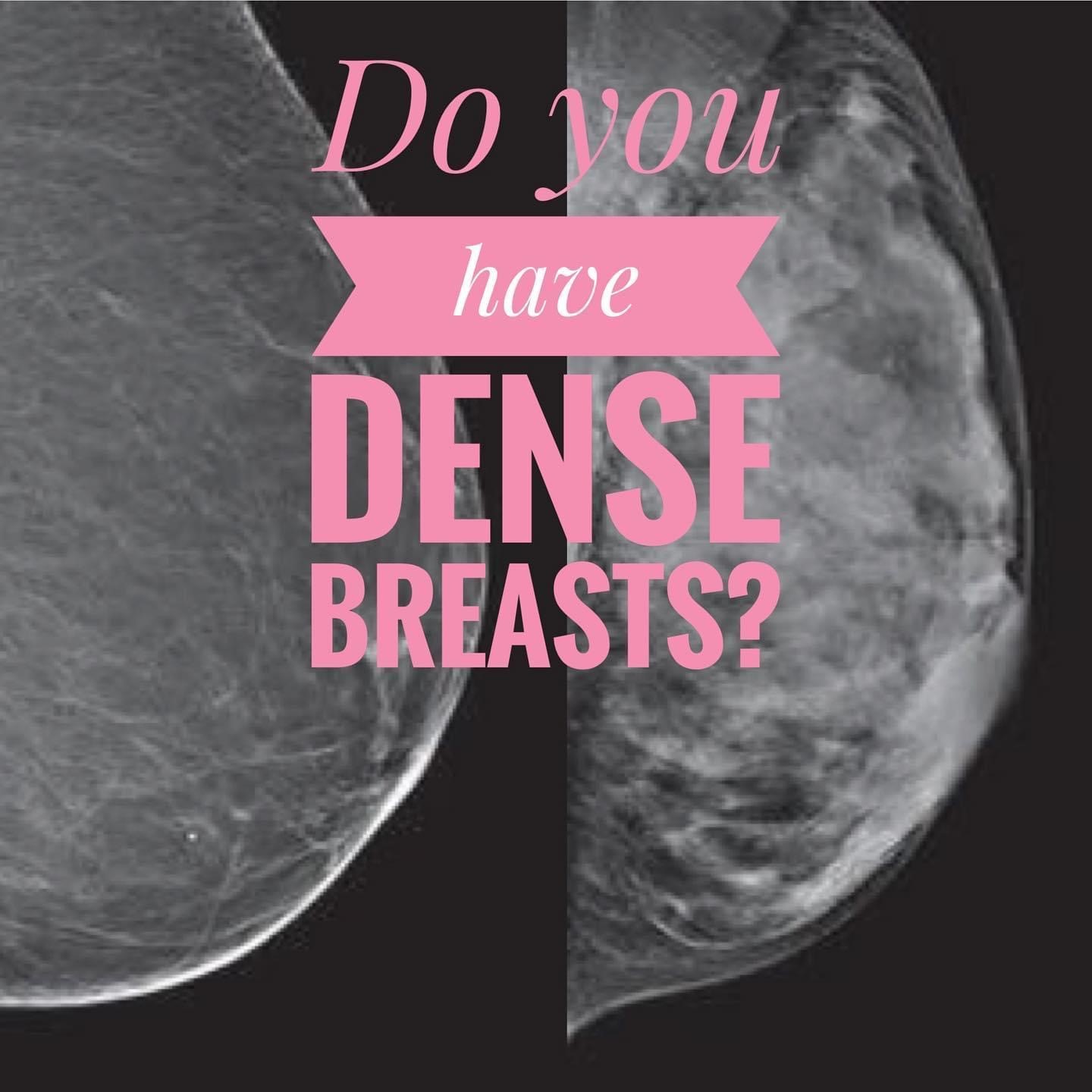 Do you have dense breasts?